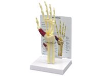 GPI Anatomicals® Wrist/Hand Carpal Tunnel Syndrome Model