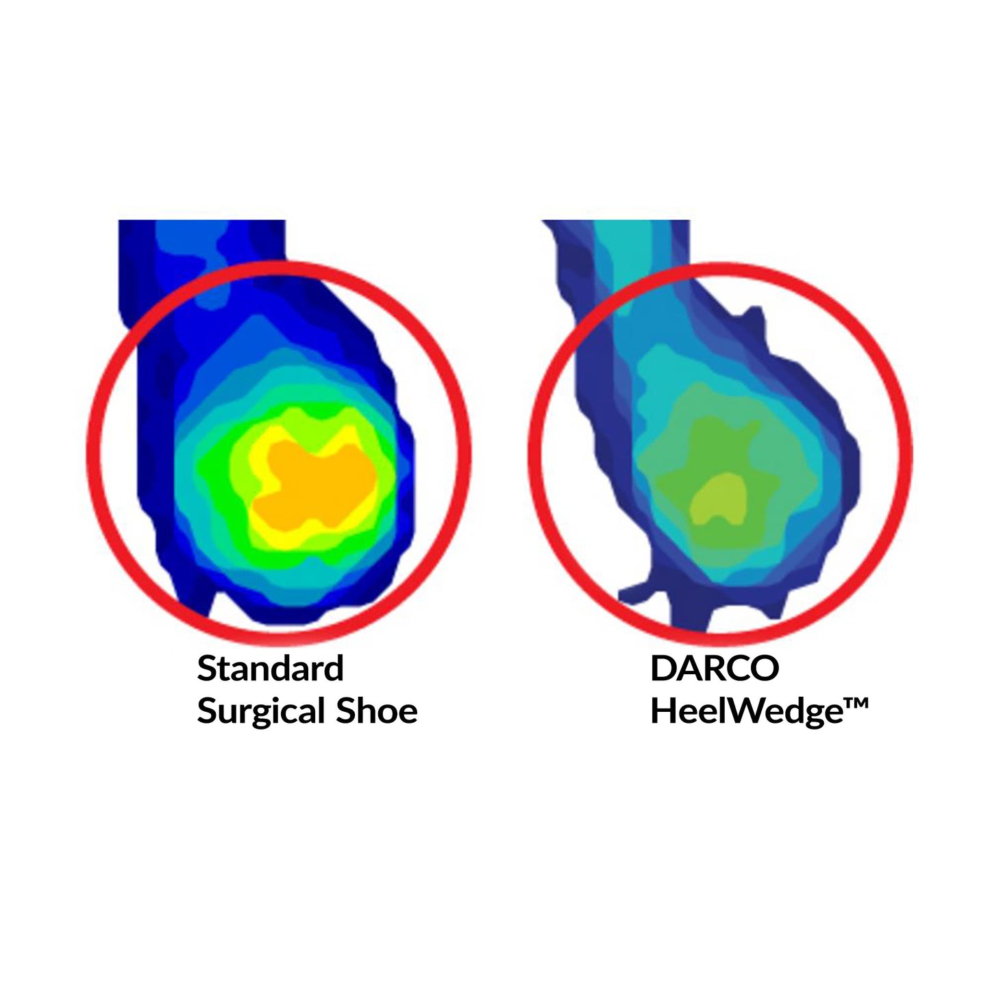 Comparison image of pressure distribution: a standard surgical shoe (left) and the DARCO HeelWedge Healing Shoe (right).