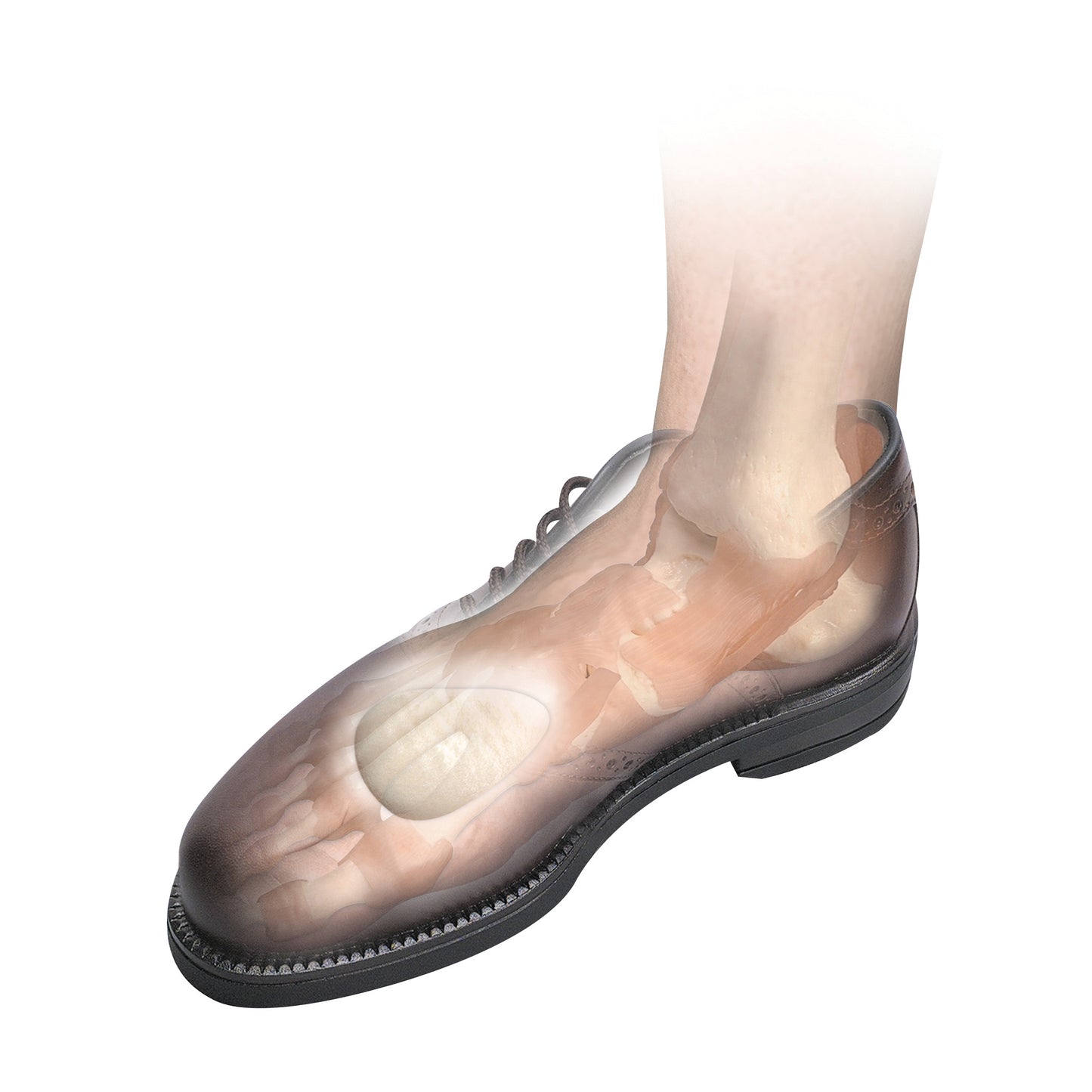 Illustration showing a transparent shoe revealing foot anatomy with a Hapad Metatarsal Pad beneath the ball of the foot.