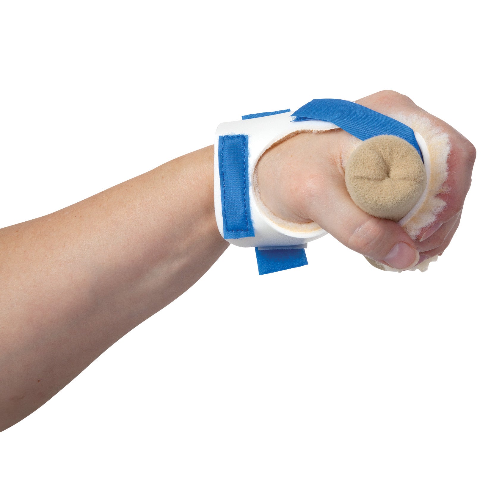 A hand wearing an AliMed Progressive Palm Guard Splint Kit, featuring a blue strap and beige pad, securely encloses the fist.