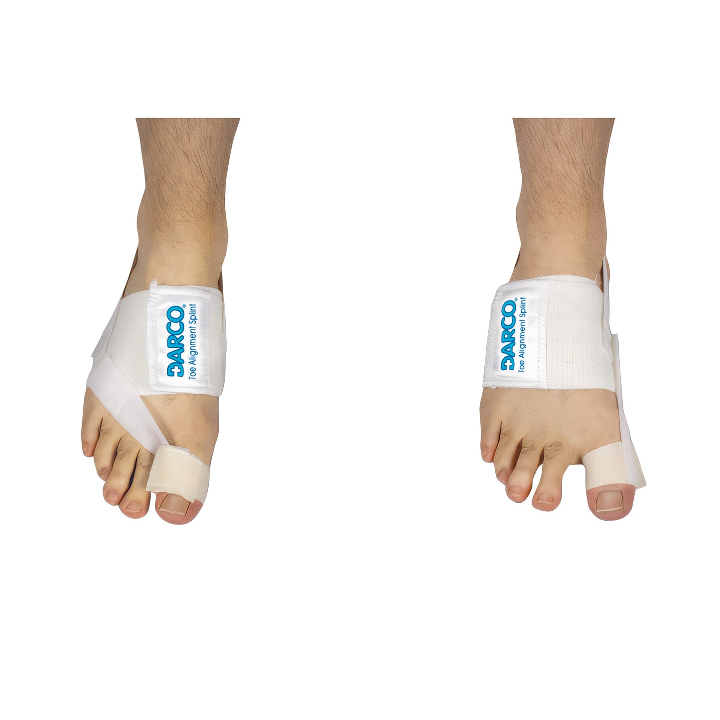 Two feet wearing DARCO Toe Alignment Splints, white orthopedic devices with straps supporting the big toes.