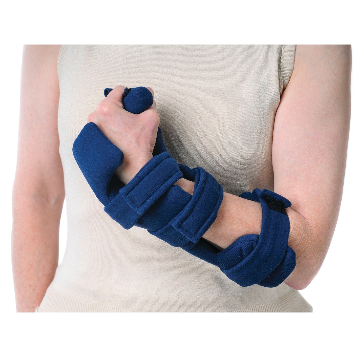 A person wears a Comfy Splints Adult Adjustable Cone Hand Orthosis on their right hand and forearm, secured with blue straps.
