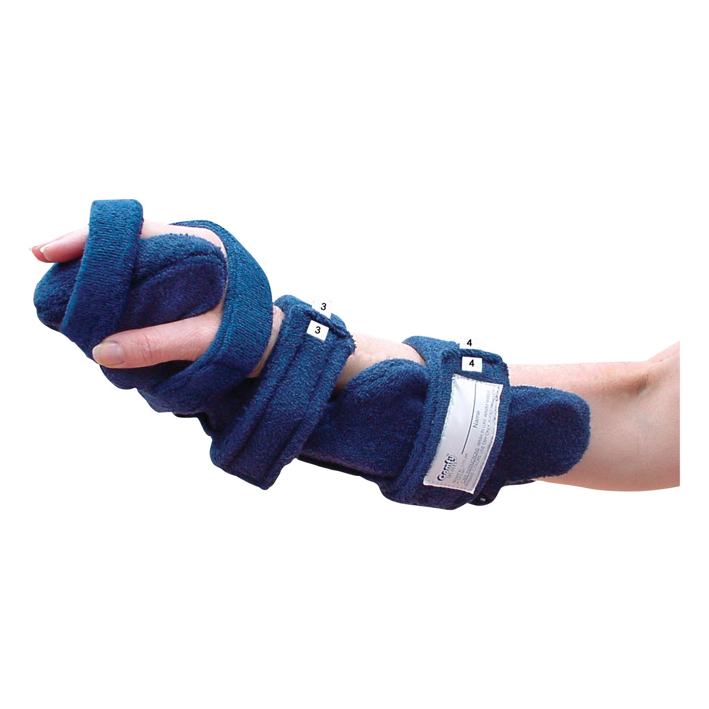 An arm is fitted with a Comfy Splints Adult Cuddler Hand/Wrist Orthosis, a blue padded support with adjustable straps.