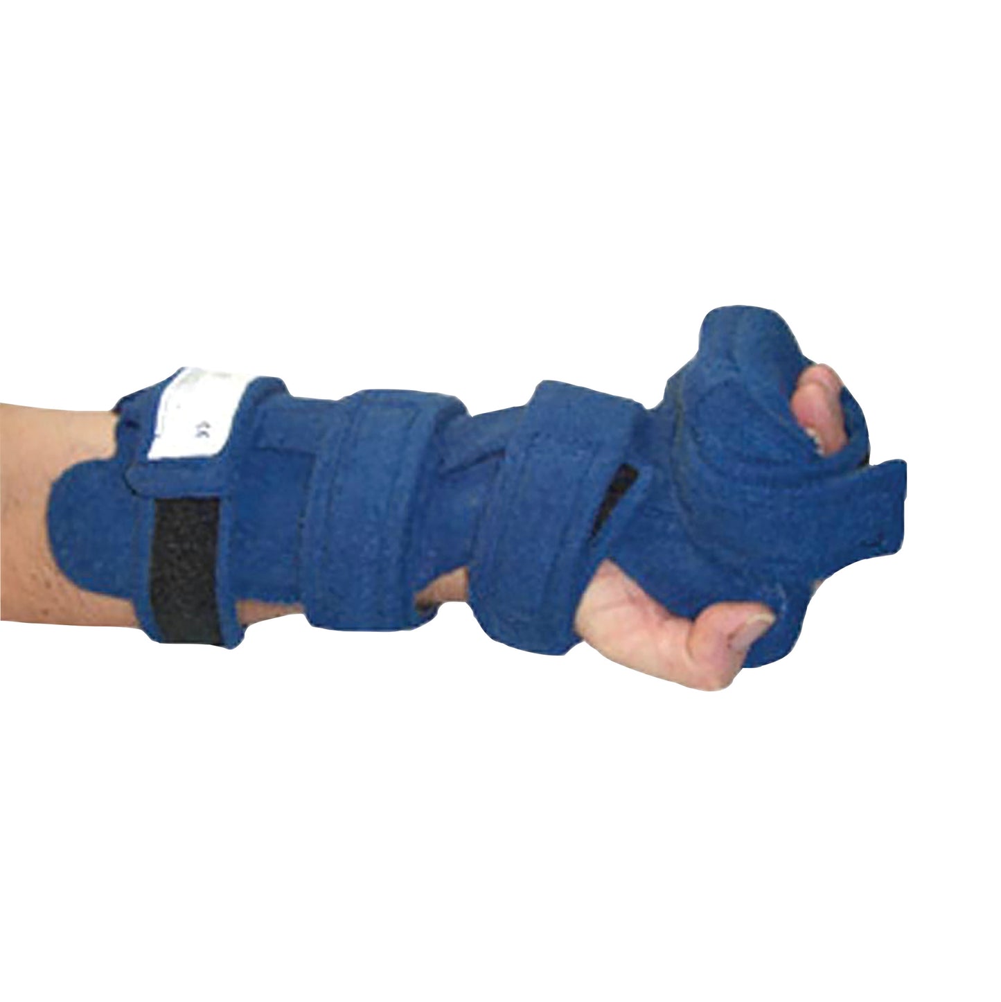 A Comfy Splints Adult Long Opponens Hand/Wrist Orthosis is shown on an arm, featuring blue padding and adjustable straps.