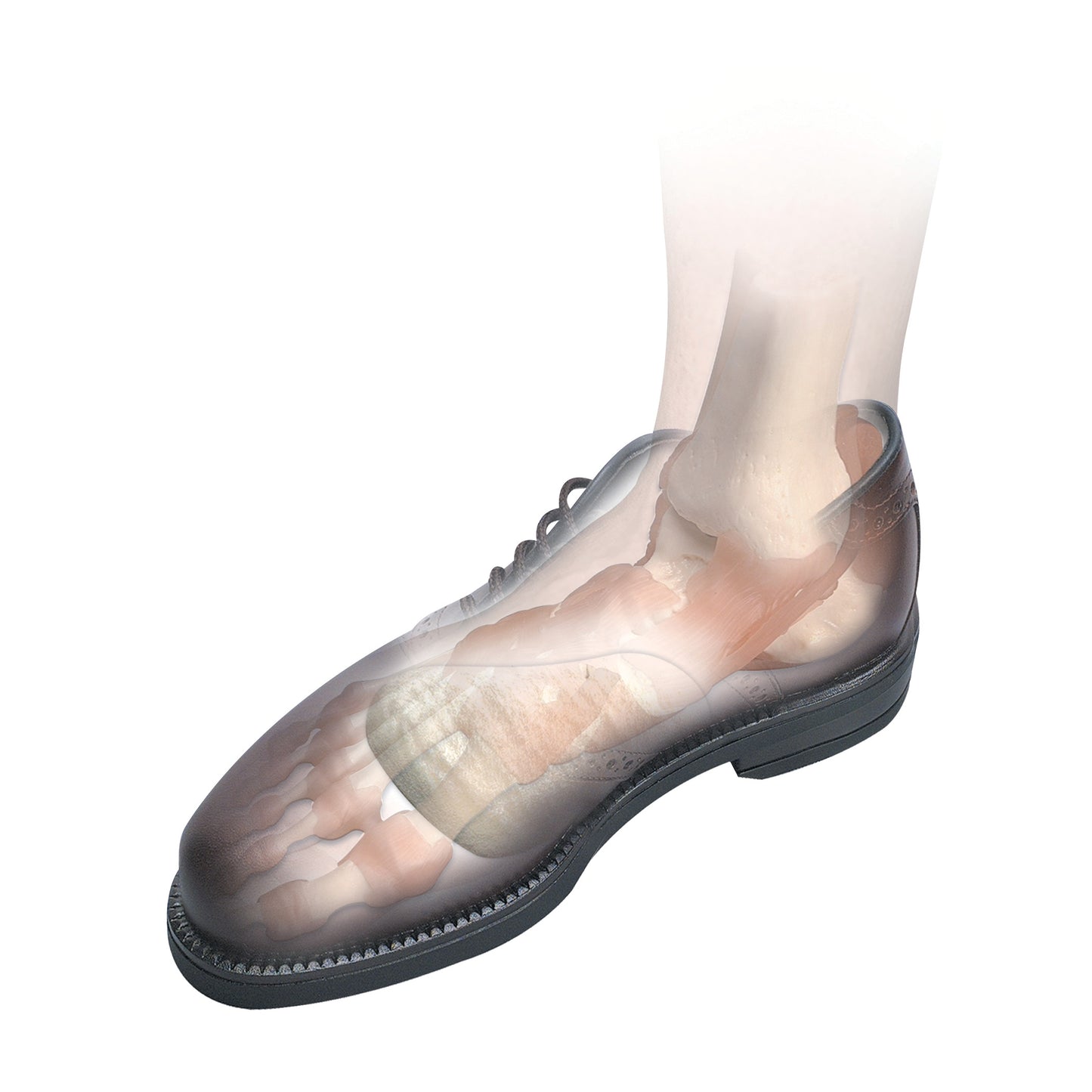 A shoe illustration showing the Hapad Longitudinal Metatarsal Arch Pad inside, supporting the foot's arch and metatarsal area.