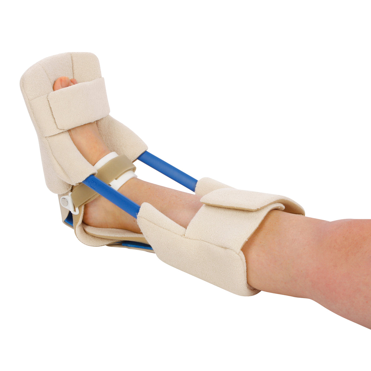 A foot is in an AliMed Turnbuckle Ankle Orthosis, featuring beige padding and blue supports, designed for ankle stabilization.