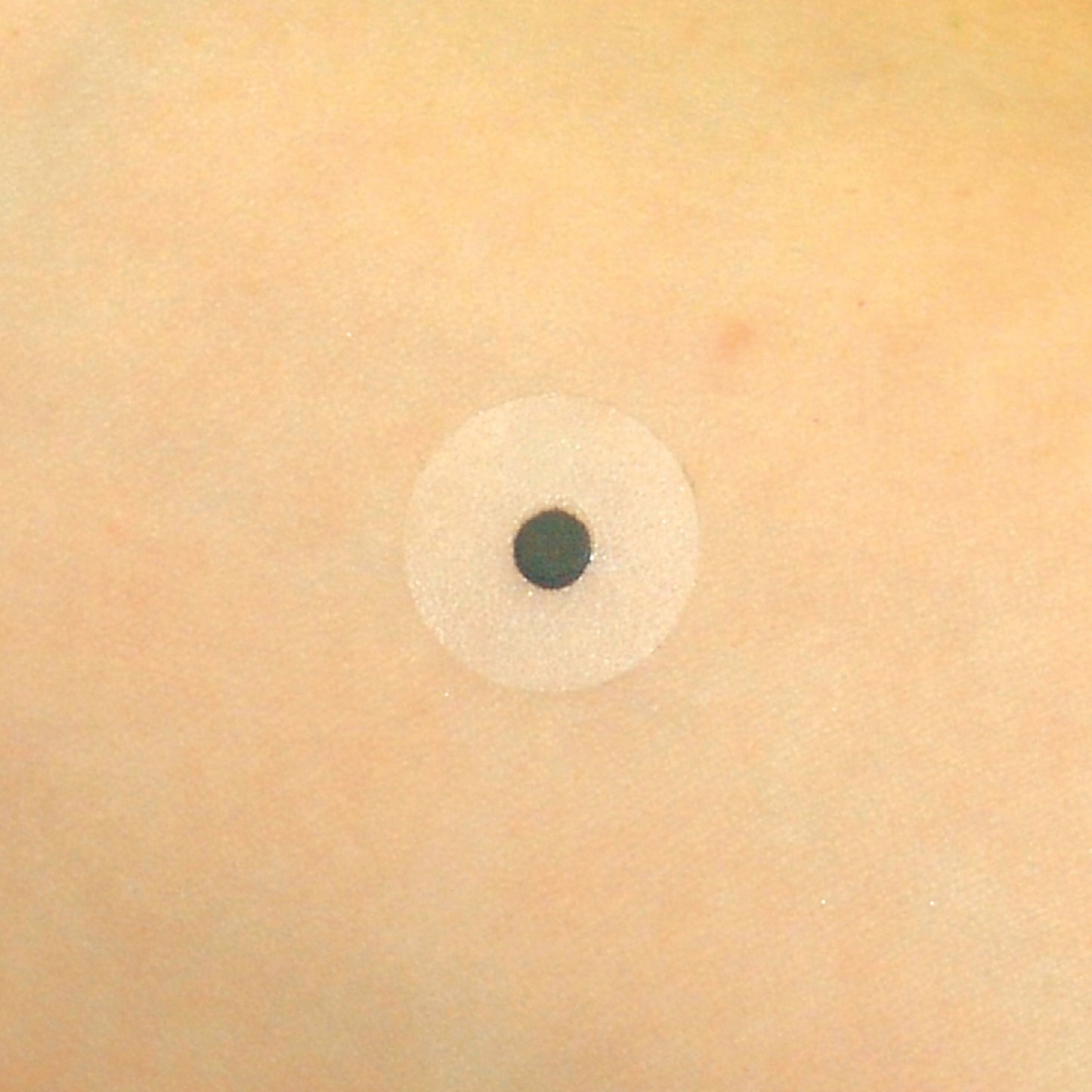A circular Indicator Radiopaque Marker with a central black dot is placed on skin. The marker is semi-transparent.