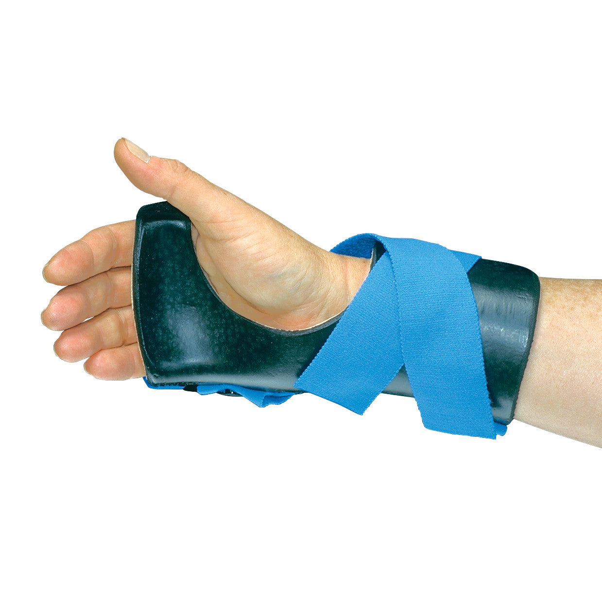 A hand wearing an AliMed Long Ulnar Deviation Wrist Splint with a blue strap wrapped around the wrist and forearm.