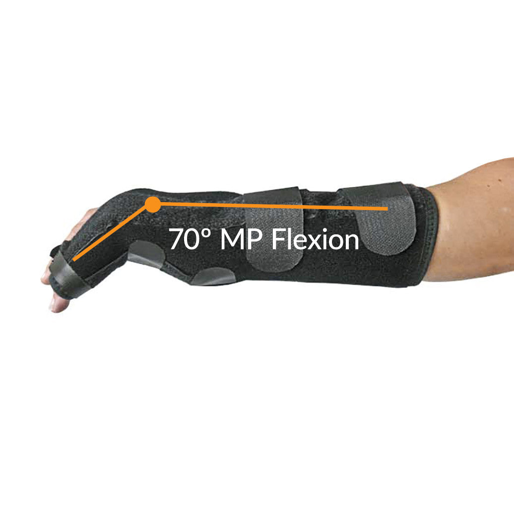 An arm wearing the EZY Wrap Boxer Fracture Brace, showing 70� MP Flexion with labeled diagram on the brace.