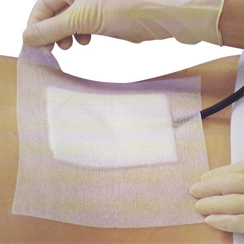 A gloved hand applies a Hypafix Dressing Retention Roll over a padded area on skin, securing a medical tube in place.