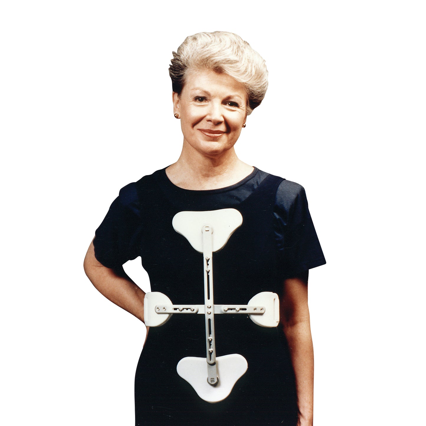 A woman wears the Trulife CASH Spinal Hyperextension Orthosis with Hinged Sternal Pad, a brace with a cross-shaped design.