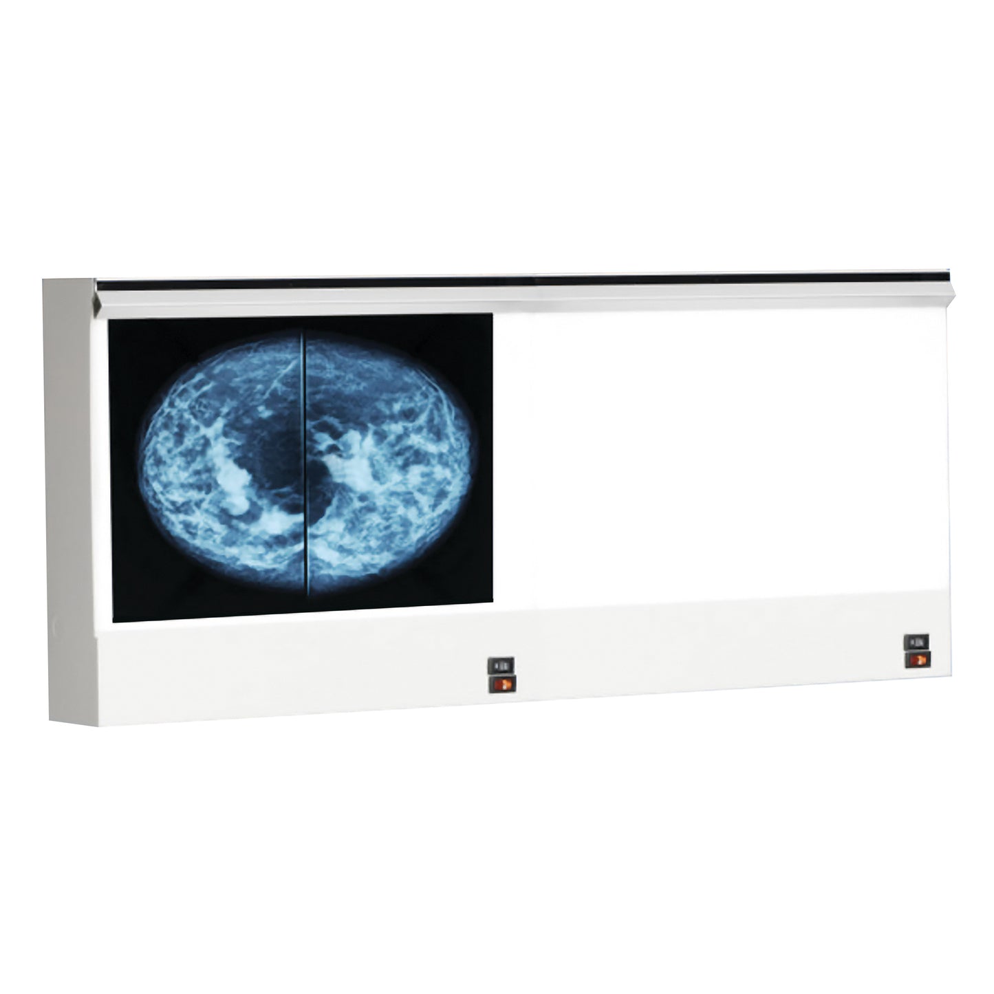 The Wolf VuPlus Mammography Viewer displays an X-ray image of a mammogram on its illuminated panel against a white background.
