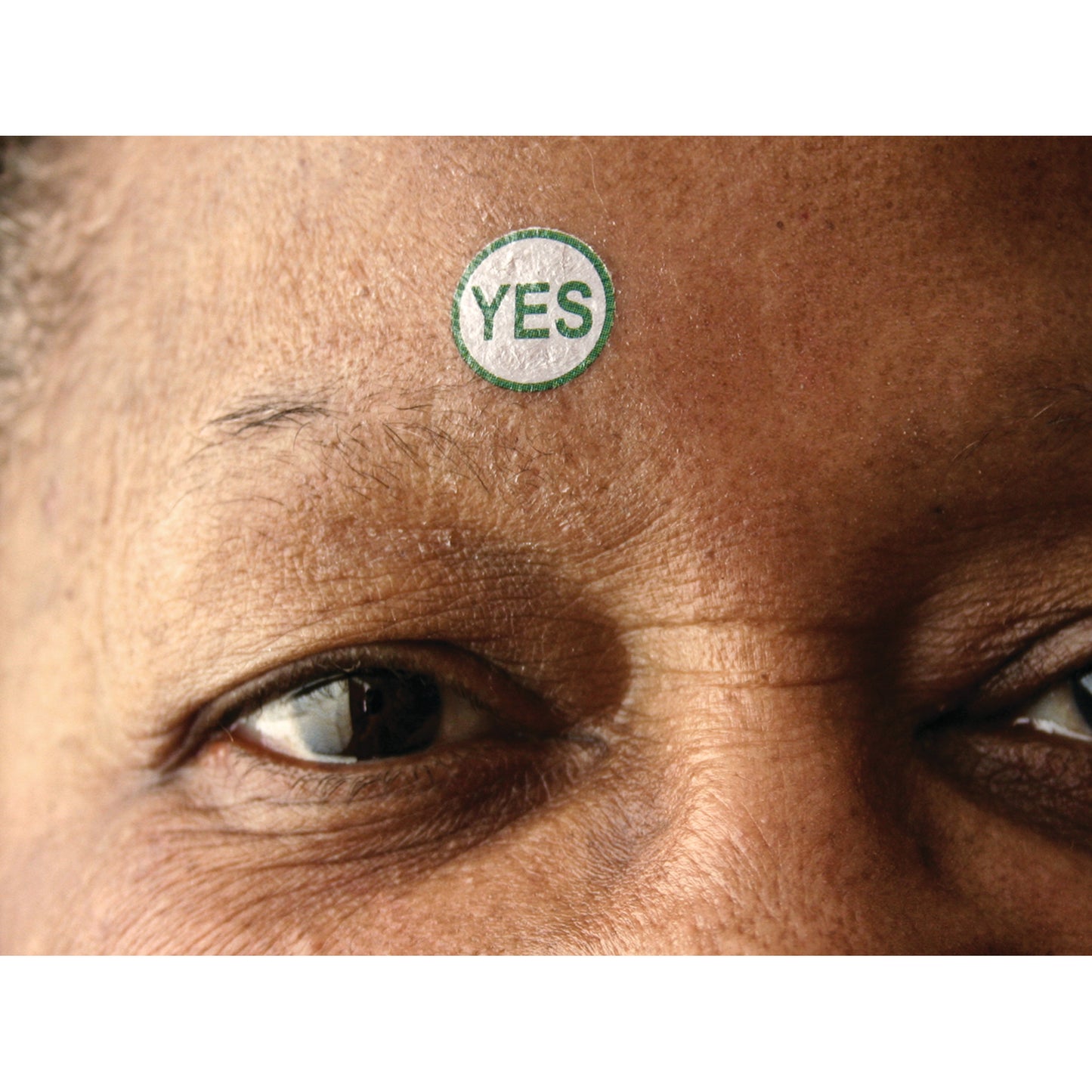 Close-up of a person's forehead with a Viscot TAT "YES" Marker sticker applied. The sticker is circular with "YES" in green text.