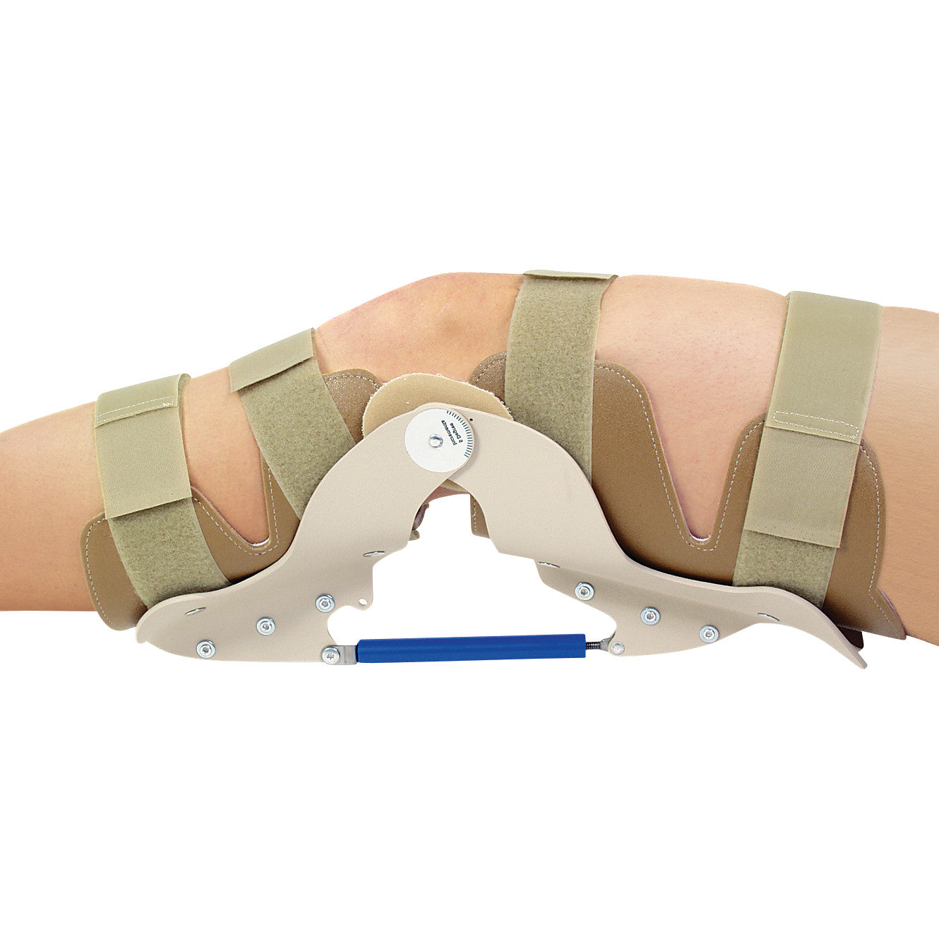A knee wearing an AliMed Turnbuckle Knee Orthosis with beige straps and a blue turnbuckle, designed for adjustable support.