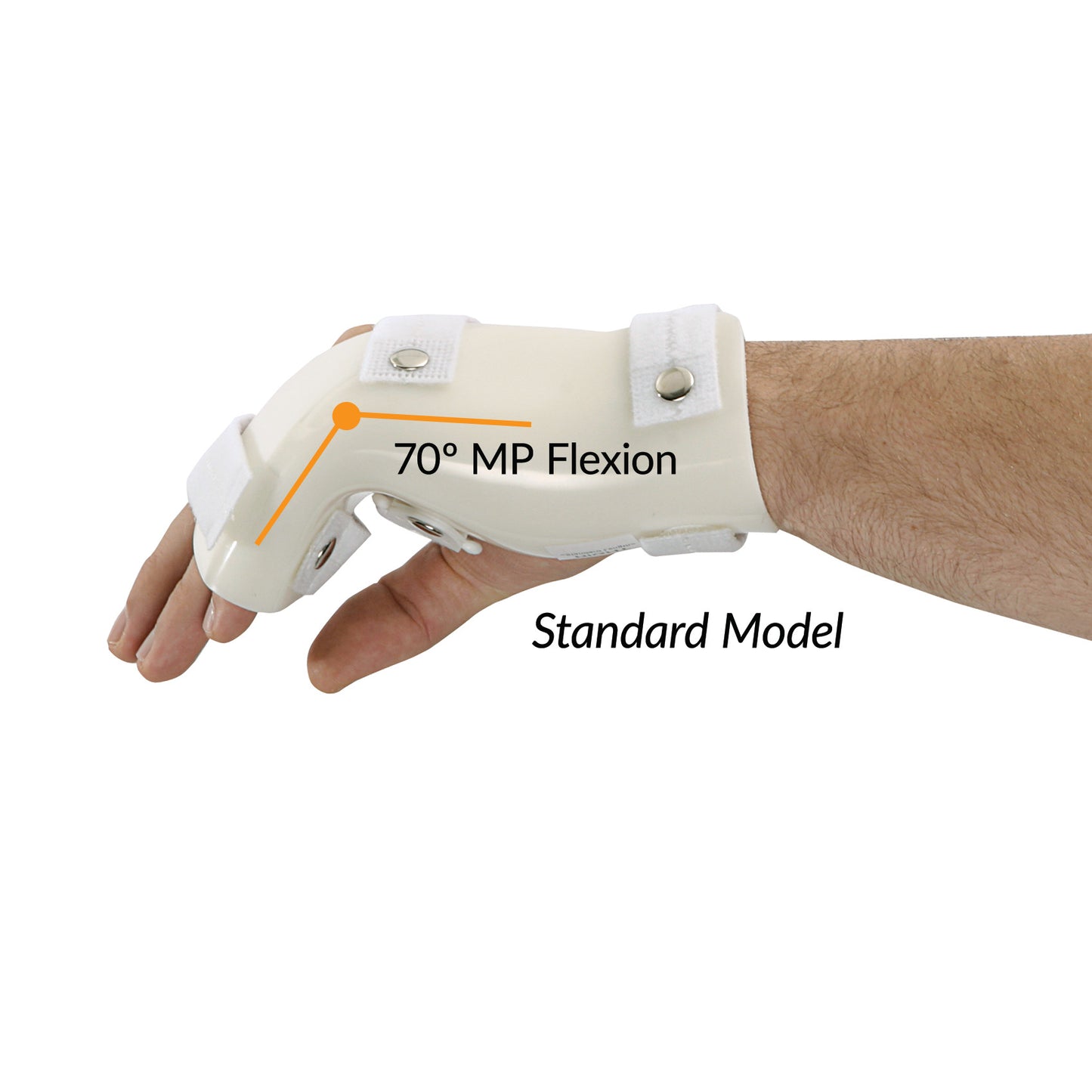 A forearm wearing a G-Force Boxers Splint with MP Flexion, showing 70 degree MP flexion and secured with white straps