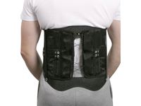 AliMed® Shadow Modular Spinal System