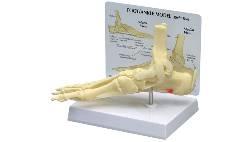 GPI Anatomicals® Foot/Ankle Plantar Fasciitis Model