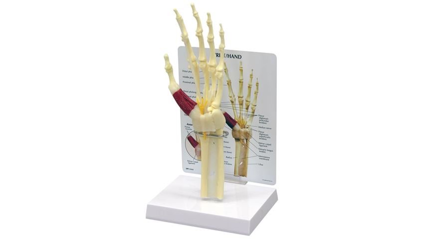 GPI Anatomicals® Wrist/Hand Carpal Tunnel Syndrome Model