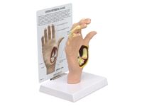 GPI Anatomicals® Osteoarthritis (OA) Hand Model