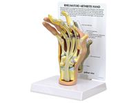 GPI Anatomicals® Rheumatoid Arthritis (RA) Hand Model