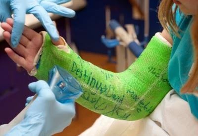 doctor taking cast off with cast saw