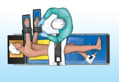 lateral positioning graphic