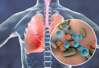 graphic of germs in lungs
