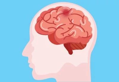 graphic of human brain