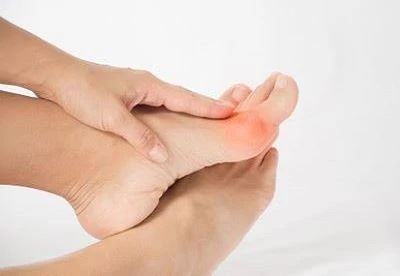 person rubbing their foot with bunion pain point