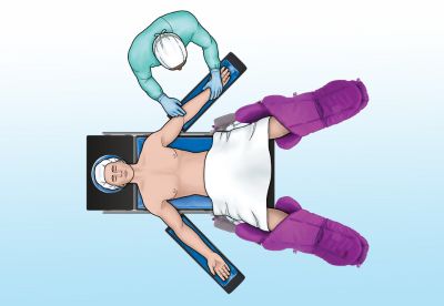 graphic of patient in lithotomy position on operating table