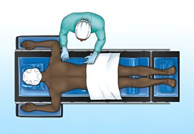 graphic of doctor next to patient lying in prone position on operating table