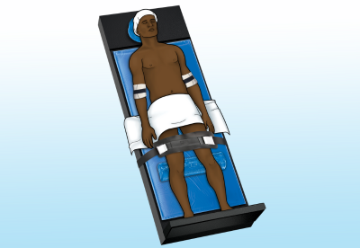graphic of patient on operating table in reverse trendelenburg position
