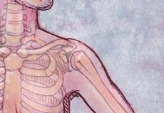 Rise in Robotic Surgeries May Lead to More Nerve Injuries