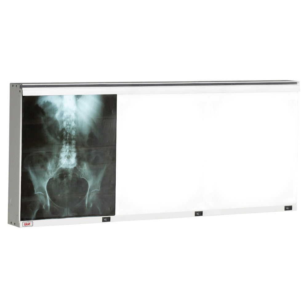 ecoline xray illuminator with spine xray