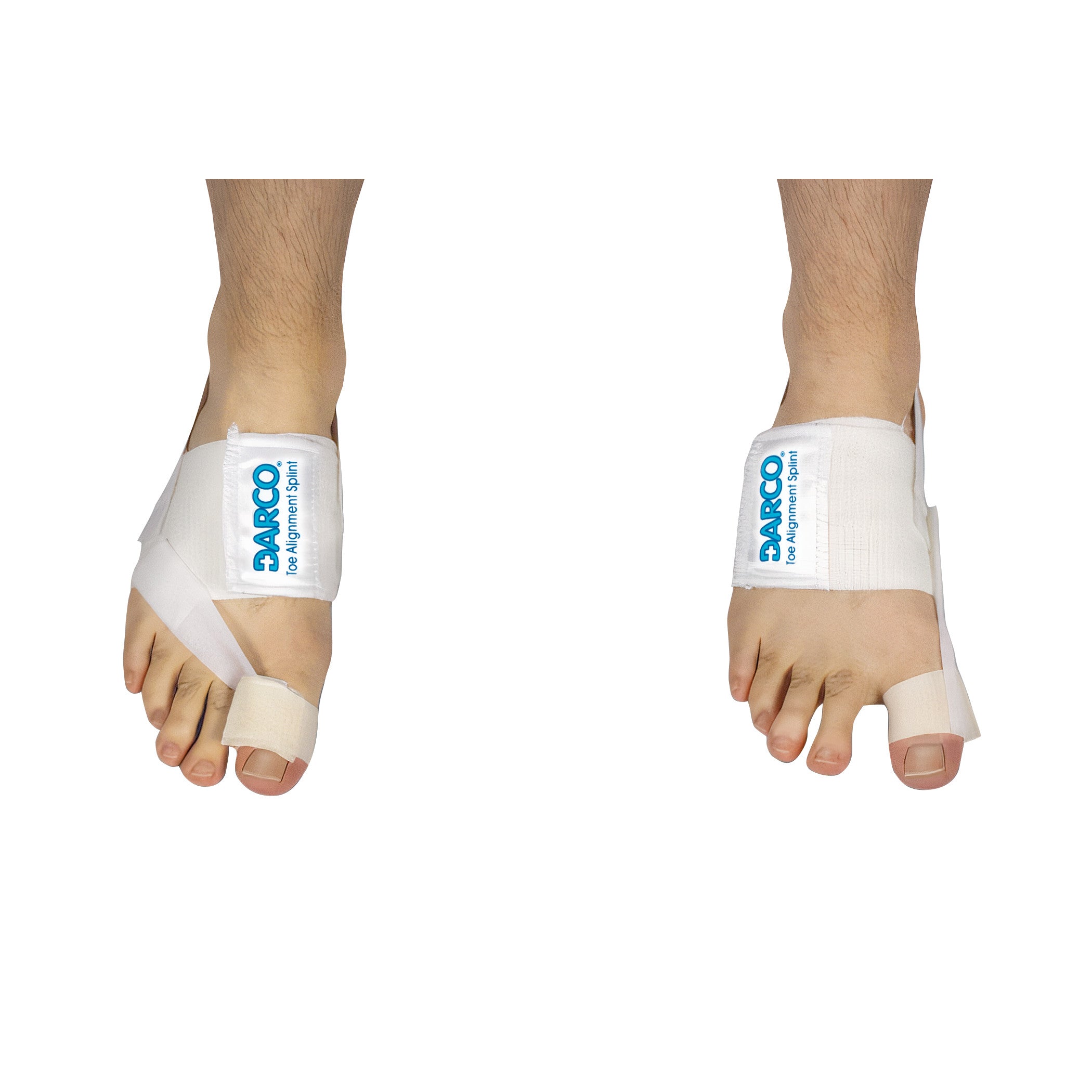 Two feet wearing DARCO Toe Alignment Splints, white orthopedic devices with straps supporting the big toes.