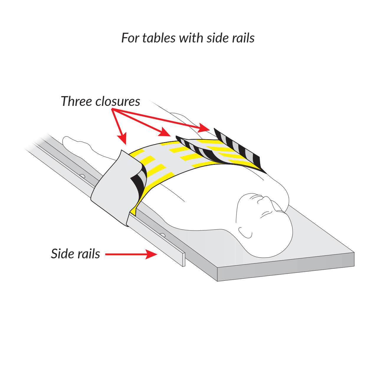 Illustration of the AliMed Radiolucent Abdominal Immobilizer with Three Closures on a person. It is secured with side rails.