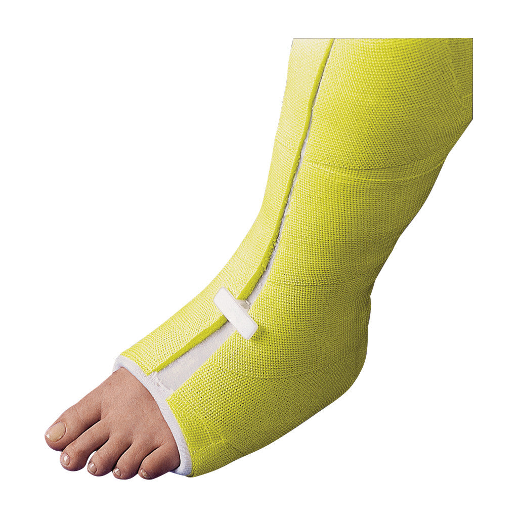 A yellow leg cast with an exposed foot features the Replacement Wedge for CastWedge Starter Set, visible on the side.