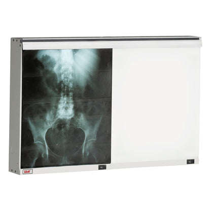 The Wolf Econoline Illuminator displays an X-ray image of the lower spine and pelvis on a backlit viewing screen.