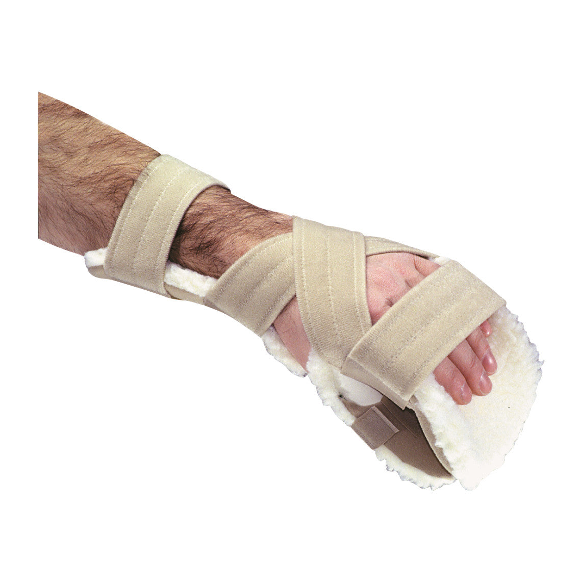 A person's hand wearing an AliMed Progressive Resting Splint with beige straps and a white, padded interior for support.