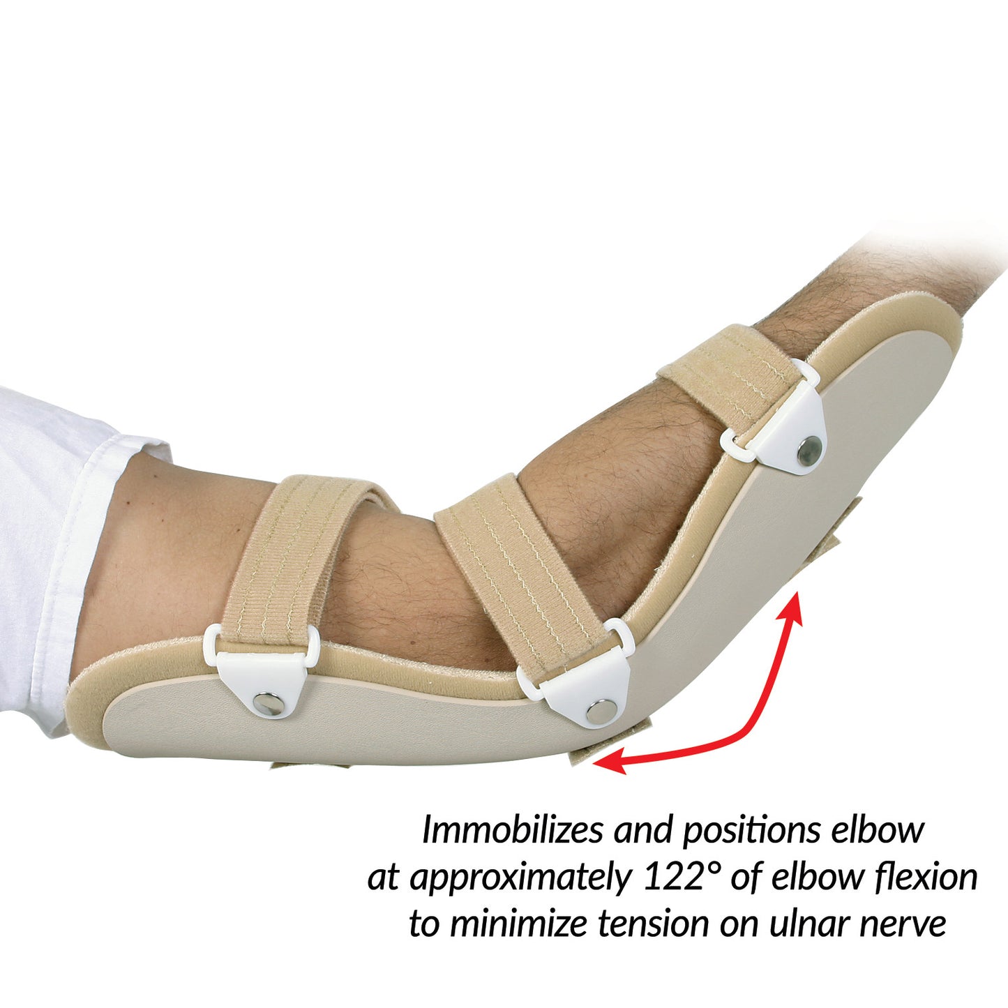 A person's arm wearing the AliMed Cubital Tunnel Splint, immobilizing the elbow at a 122� angle to reduce ulnar nerve tension.