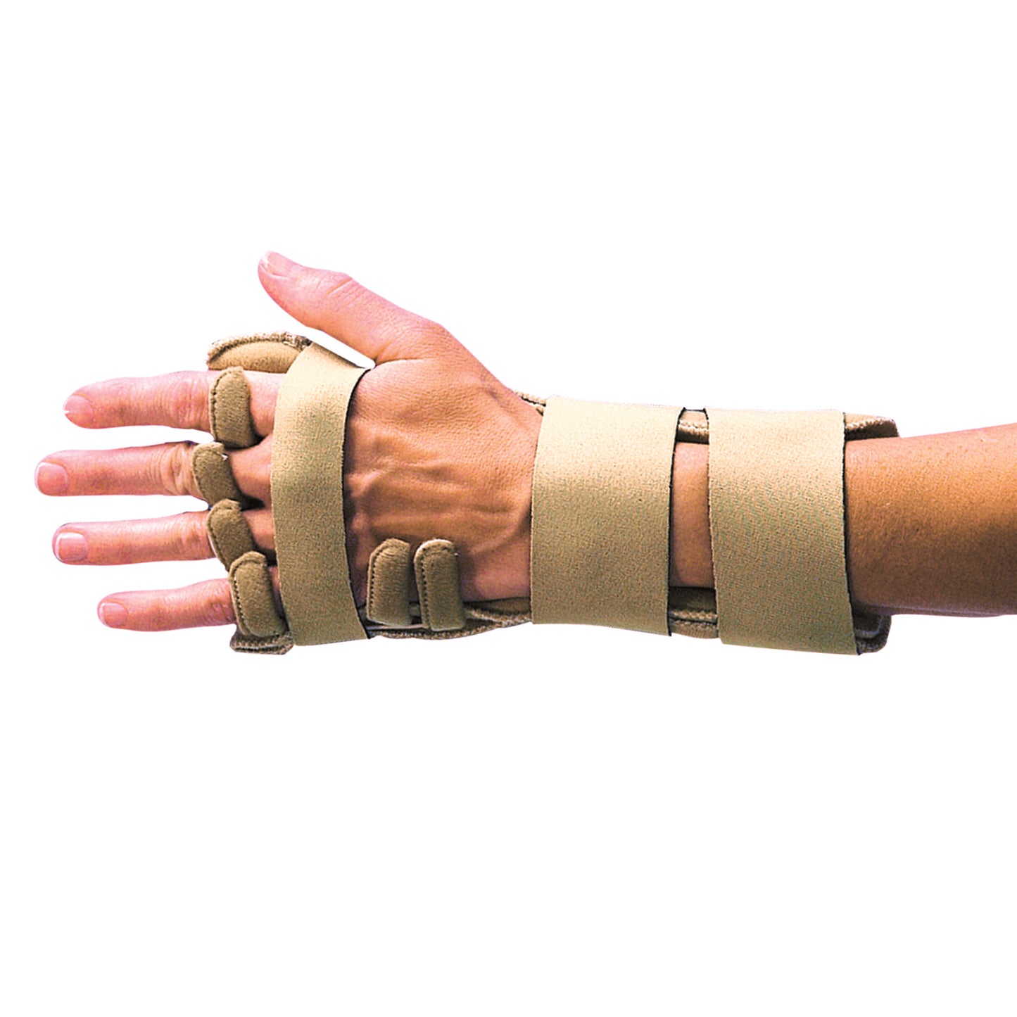 A hand wearing a 3pp Comforter Splint, beige with straps, supports the wrist and fingers for immobilization.
