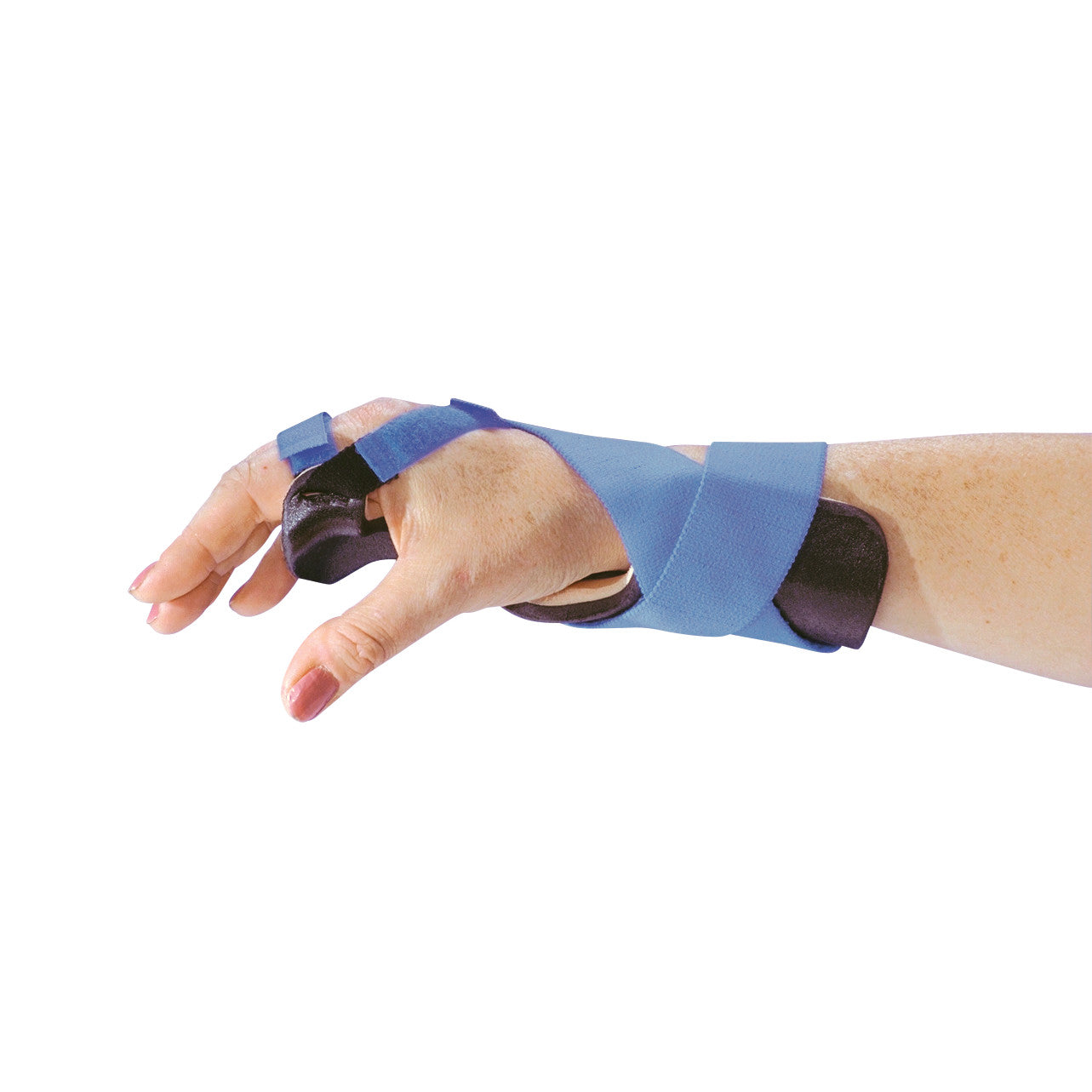 A person wears the AliMed Long Ulnar Deviation Wrist Splint with blue straps to support the hand and fingers in a neutral position.
