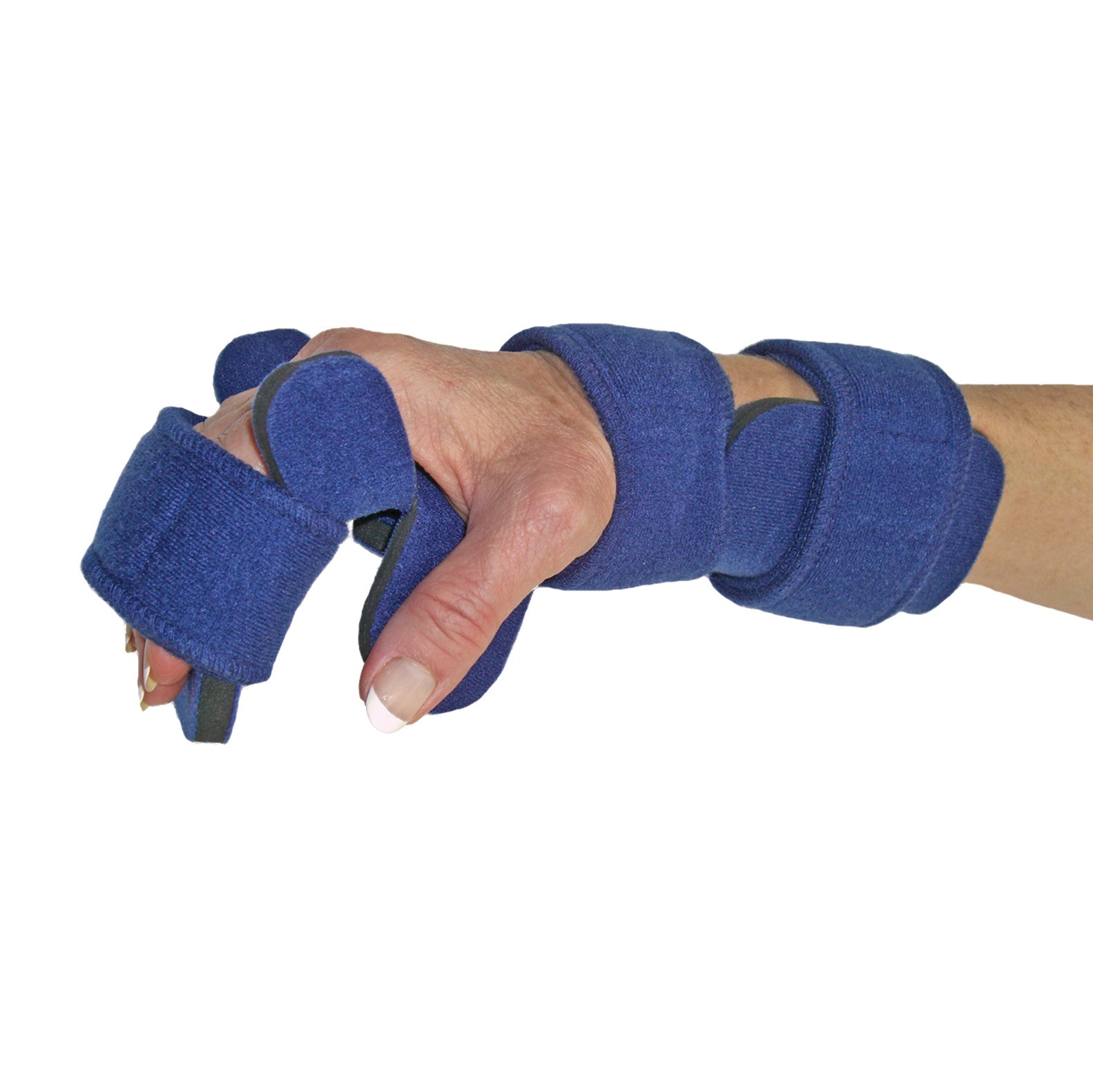 A person wearing a Comfy Splints Adult Hand/Thumb Orthosis. The blue splint supports the hand, thumb, and wrist.