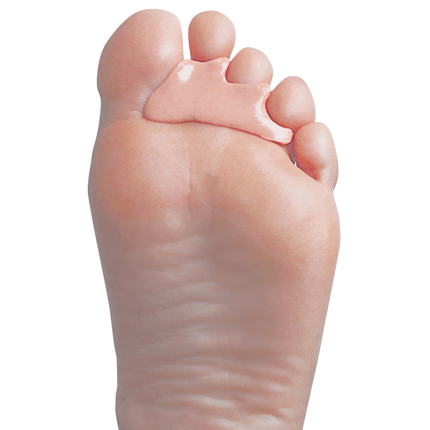A foot with PediFix PediPlast Moldable Podiatric Compound applied between the toes, showing a smooth, pink protective layer.