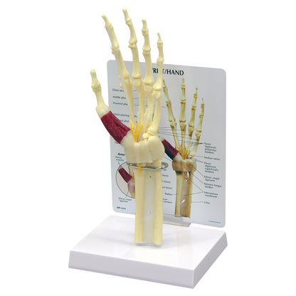 GPI Anatomicals Wrist/Hand Carpal Tunnel Syndrome Model displays a skeletal hand with muscles, tendons, and nerves on a stand.