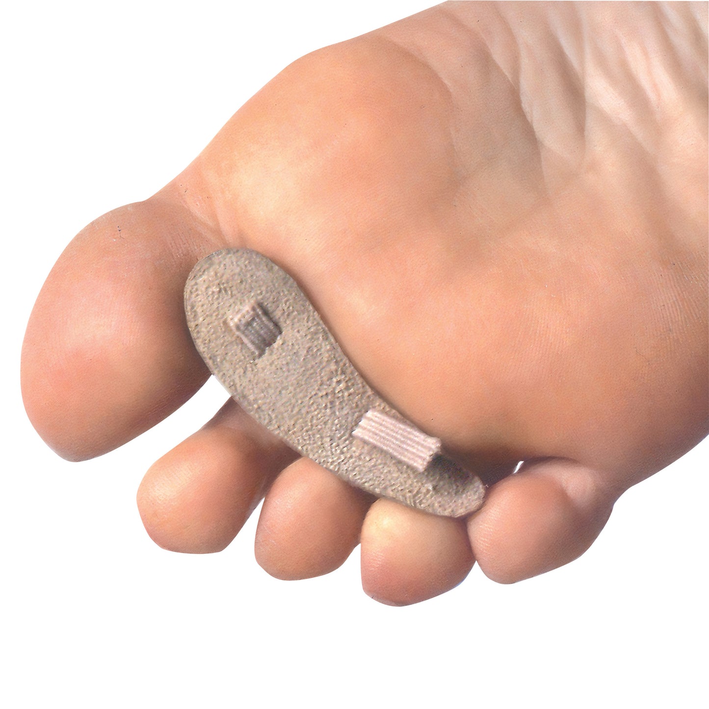 Close-up of a bare foot with a PediFix Hammertoe Crest (Buttress Pad) positioned under the toes for support and alignment.