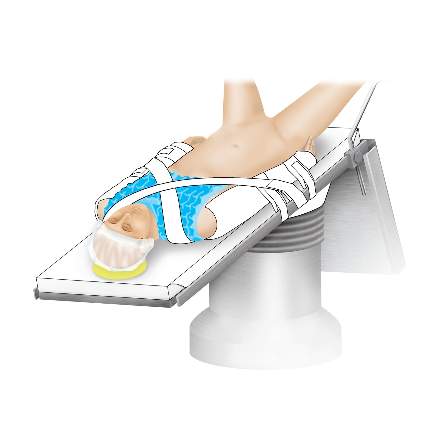 The AliMed Trendelenburg Stabilizer. It's used to securely position a patient on a surgical table during procedures.
