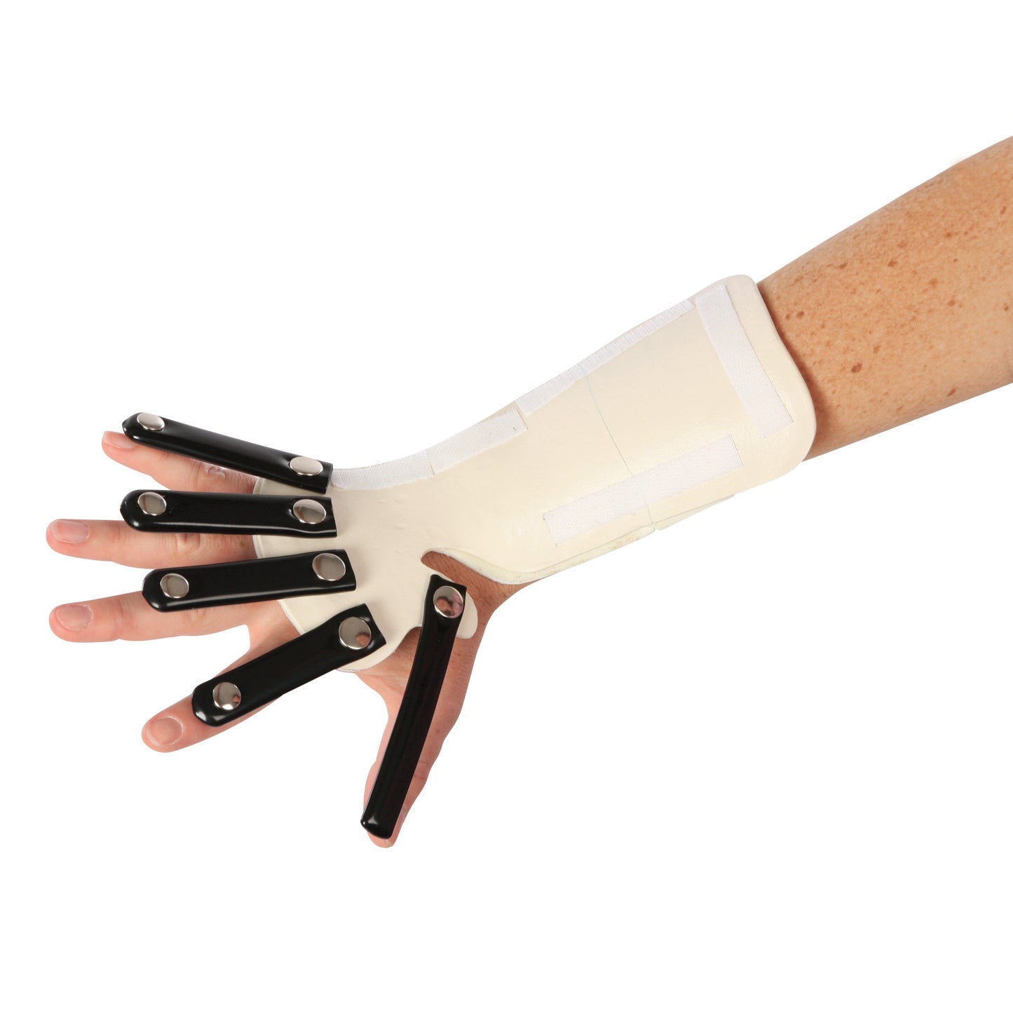 A person wears an AliMed Forearm-Based Radial Nerve Splint, featuring black metal supports attached to the fingers and thumb.