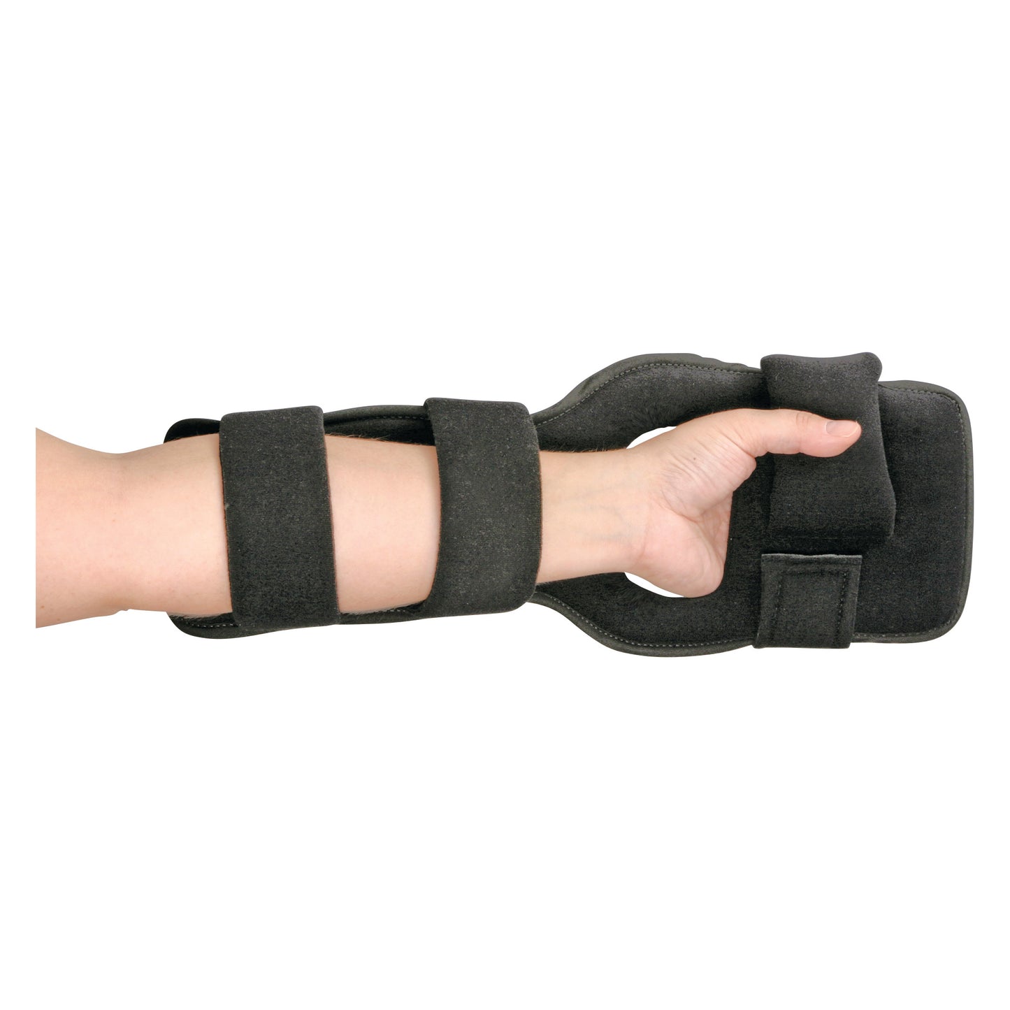 A hand and forearm wearing the AliMed Dorsal Resting Splint, featuring two black straps for support and immobilization.