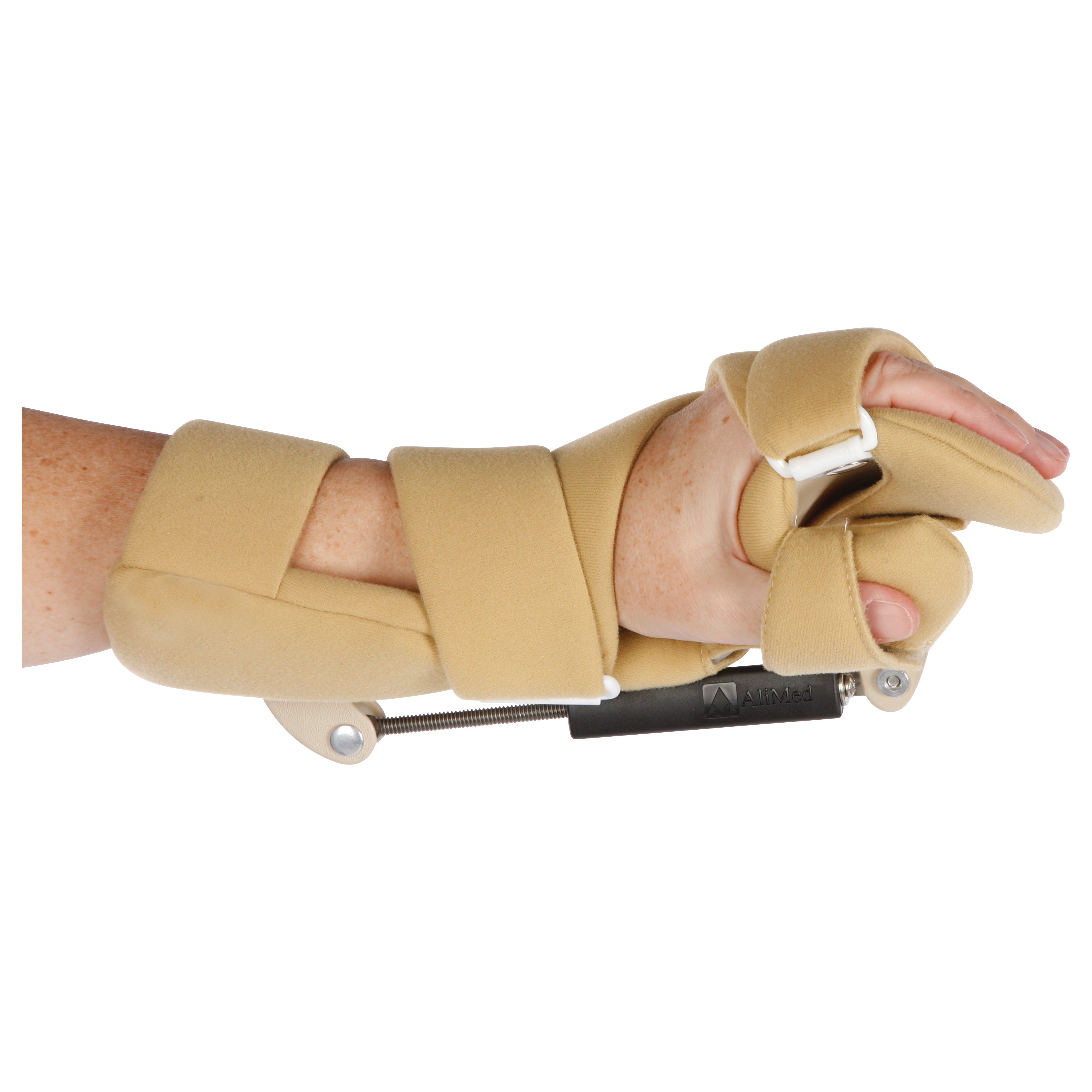 A person wearing an AliMed Turnbuckle Functional Position Hand Splint, designed to support and align the wrist and fingers.